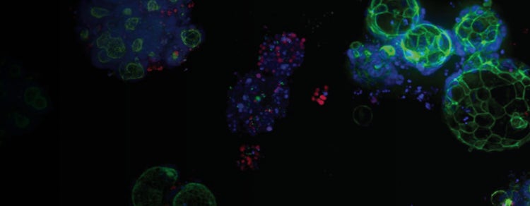3D Ready Organoids
