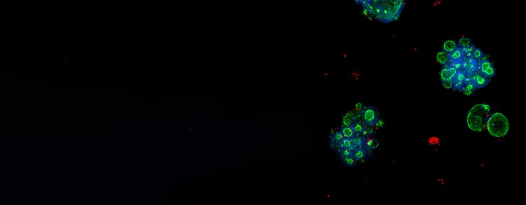 3D Ready Organoid
