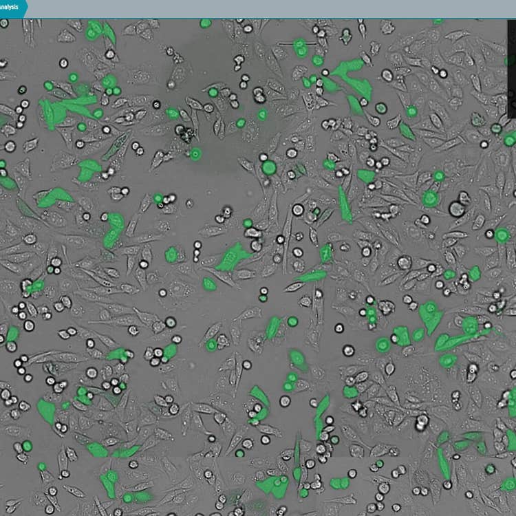 在 ImageXpress Nano 系统上使用 CellReporterXpress 软件捕获透射光和 GFP 重叠