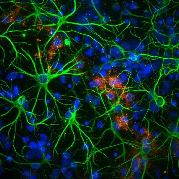 使用 ImageXpress Micro Confocal 系统以 60X PA 捕获 1536 孔中的神经元